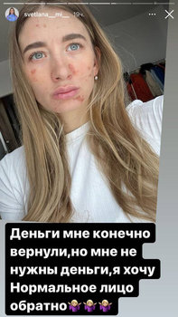 «Я желаю обычное лицо назад». Биатлонистку российской командой исковеркали докторы